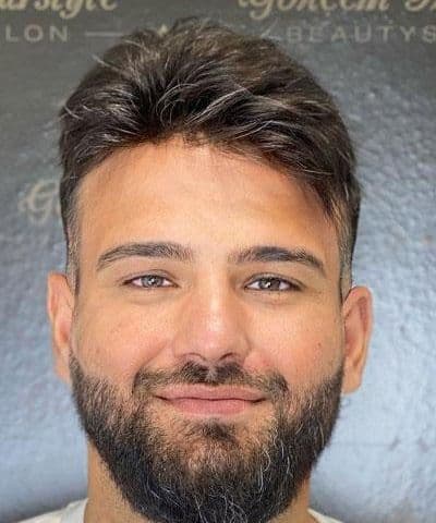 Advanced Crown Baldness to Full Density Volume - After transformation